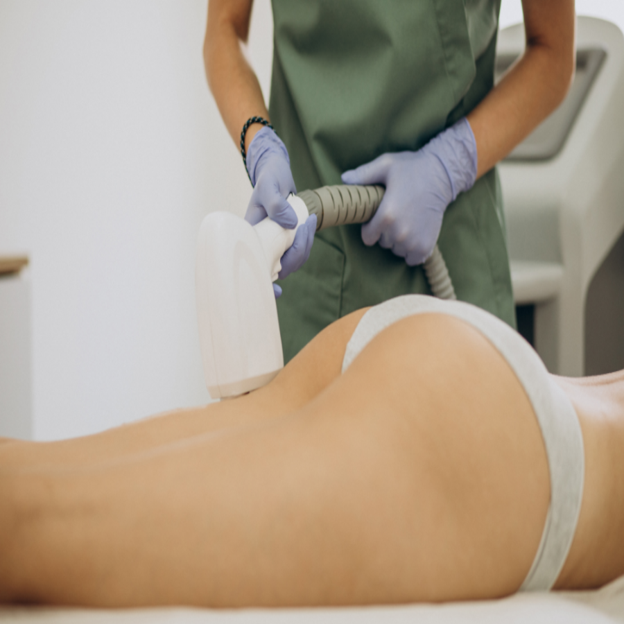 Estética - Celulite e gordura localizada 1 Ozônio terapia