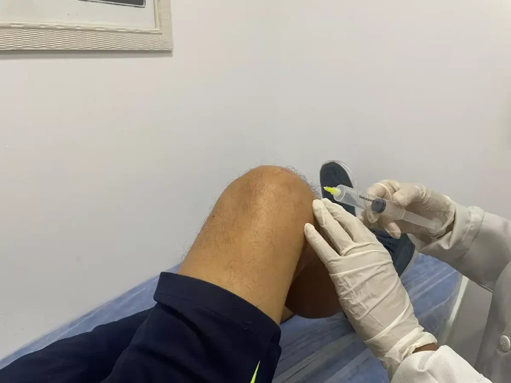 Home 13 Enfermeira aplicando tratamento com ozônio no joelho de paciente para alívio da dor e regeneração articular causada por artrose.